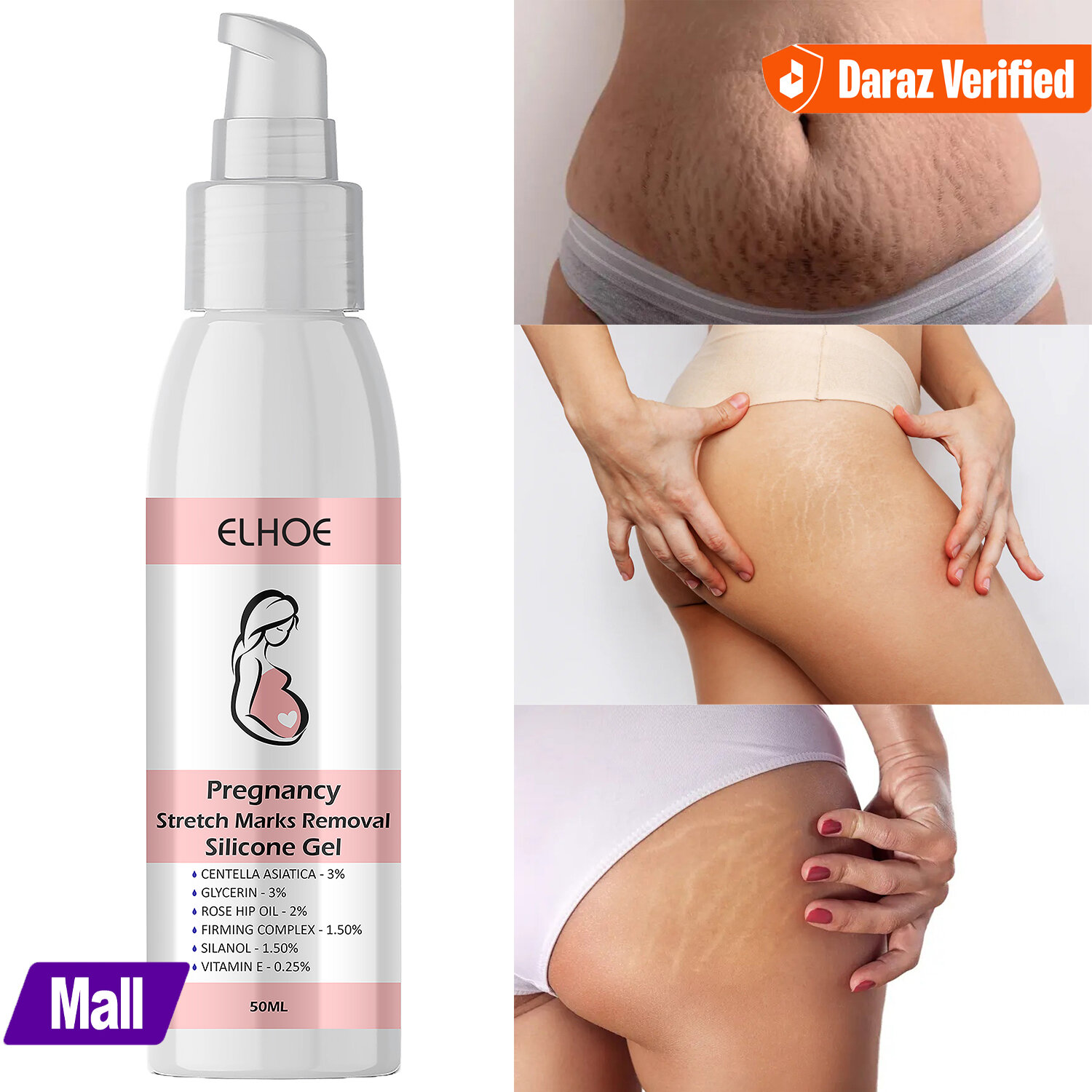EELHOE Scar Removal Cream Gel Burn Surgical Scar Cesarean Scar Repairing Stretch Marks Pigmentation Corrector