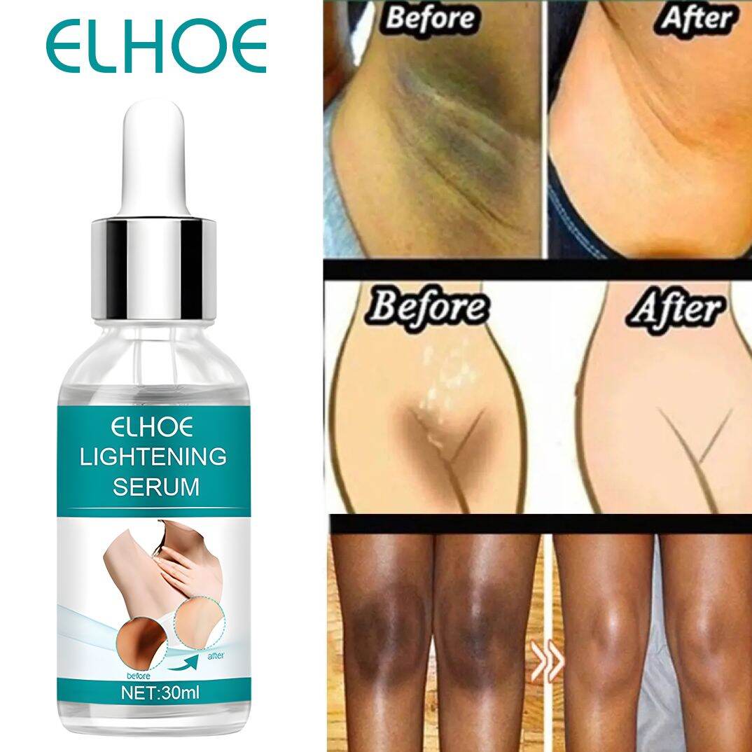 EELHOE Dark Underarm Brightener Professional Quality Korean Skin Darkness Remover